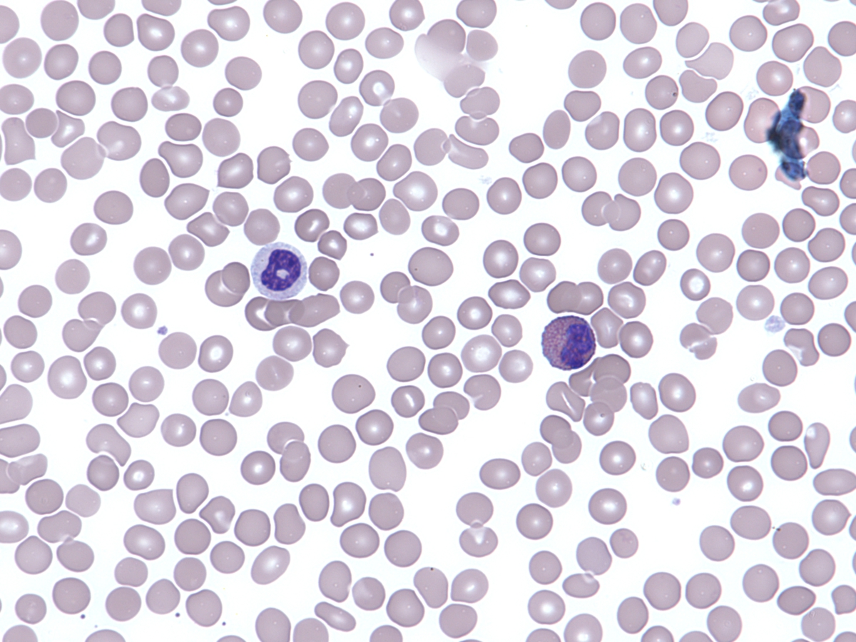 Peripheral blood
